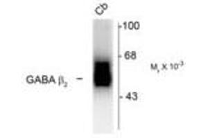 Image no. 1 for anti-gamma-aminobutyric Acid (GABA) A Receptor, beta 2 (GABRB2) (Cytoplasmic Domain) antibody (ABIN228403) (GABRB2 antibody  (Cytoplasmic Domain))