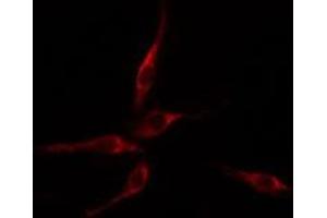 ABIN6275113 staining HepG2 cells by IF/ICC. (Epsin 2 antibody  (Internal Region))