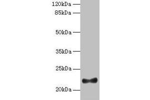 Western blot All lanes: IFNAG antibody at 2 μg/mL + HL60 whole cell lysate Secondary Goat polyclonal to rabbit IgG at 1/10000 dilution Predicted band size: 22 kDa Observed band size: 22 kDa (IFNA5 antibody  (AA 24-189))