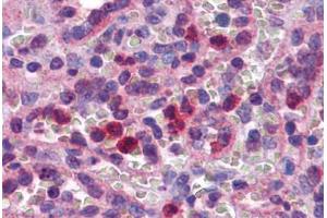 Human Spleen: Formalin-Fixed, Paraffin-Embedded (FFPE) (SCRN2 antibody  (C-Term))
