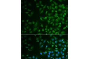 Immunofluorescence analysis of MCF7 cells using MPP2 Polyclonal Antibody (MPP2 antibody)