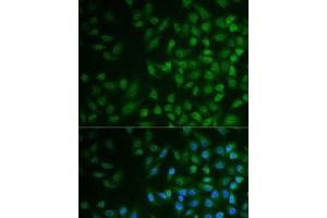 Immunofluorescence analysis of MCF7 cells using MPP2 Polyclonal Antibody