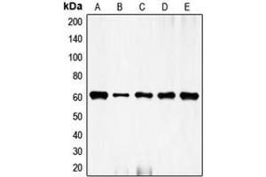 Western blot analysis of c-FOS expression in HeLa (A), NIH3T3 (B), mouse brain (C), rat kidney (D), rat brain (E) whole cell lysates. (c-FOS antibody  (N-Term))