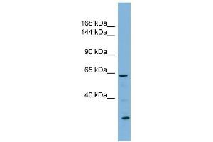 Klotho antibody used at 1 ug/ml to detect target protein. (Klotho antibody  (N-Term))