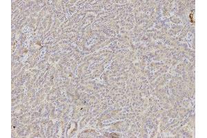 Immunohistochemistry (IHC) image for anti-DKK3 antibody (ABIN1872281) (DKK3 antibody)