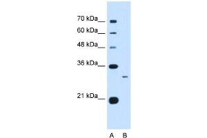 C1QB antibody used at 0.