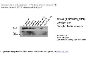 Western Blotting (WB) image for anti-Cyclin A2 (CCNA2) (C-Term) antibody (ABIN2779289) (Cyclin A antibody  (C-Term))