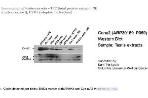 Western Blotting (WB) image for anti-Cyclin A2 (CCNA2) (C-Term) antibody (ABIN2779289)