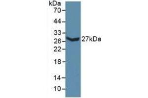 Detection of Recombinant COL3a1, Mouse using Polyclonal Antibody to Collagen Type III Alpha 1 (COL3a1) (COL3A1 antibody  (AA 434-643))