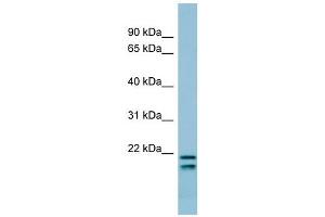 SFTPC antibody used at 1 ug/ml to detect target protein. (Surfactant Protein C antibody  (N-Term))