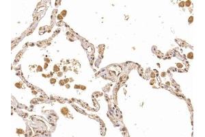 Detection of FLI1 in Human Lung Tissue using Polyclonal Antibody to Friend Leukemia Virus Integration 1 (FLI1) (FLI1 antibody  (AA 1-196))