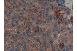 Immunohistochemistry (IHC) image for anti-Leukemia Inhibitory Factor Receptor alpha (LIFR) (AA 152-291) antibody (ABIN7432040)