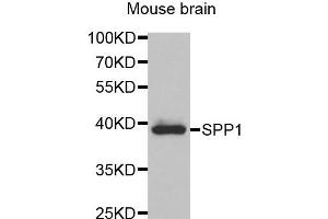 Western blot analysis of extracts of Mouse brain tissue, using SPP1 antibody. (Osteopontin antibody)