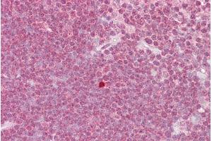 Immunohistochemistry with Thymus tissue at an antibody concentration of 5µg/ml using anti-ZBTB7A antibody (ARP39211_P050) (ZBTB7A antibody  (N-Term))