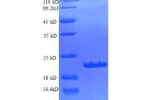 SDS-PAGE (SDS) image for Spermidine/spermine N1-Acetyltransferase 1 (SAT1) protein (His tag) (ABIN5712255) (SAT1 Protein (His tag))