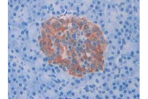 Detection of Slit1 in Human Pancreas Tissue using Polyclonal Antibody to Slit Homolog 1 (Slit1) (SLIT1 antibody  (AA 647-835))