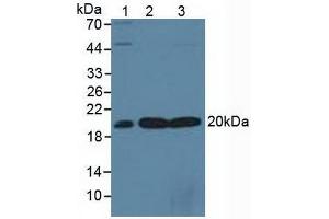 Figure. (SKP1 antibody  (AA 1-163))