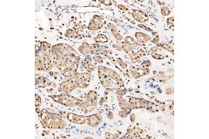 IHC analysis of SNRNP27 using anti-SNRNP27 antibody (ABIN7599614). (SNRNP27 antibody  (AA 100-155))