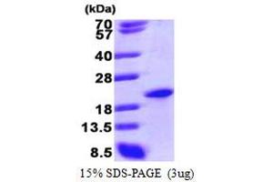 SDS-PAGE (SDS) image for Sin3A-Associated Protein, 18kDa (SAP18) (AA 20-172) protein (His tag) (ABIN666775)