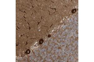 Immunohistochemical staining of human cerebellum with ECM2 polyclonal antibody  shows strong cytoplasmic and nucleolar positivity in purkinje cells at 1:200-1:500 dilution.