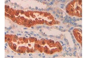 Detection of PAH in Human Kidney Tissue using Polyclonal Antibody to Phenylalanine Hydroxylase (PAH) (Phenylalanine Hydroxylase antibody  (AA 1-226))