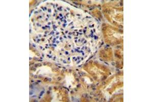 Immunohistochemistry analysis in formalin fixed and paraffin embedded human kidney tissue reacted with PEAR1 Antibody (C-term) followed which was peroxidase conjugated to the secondary antibody and followed by  DAB staining.