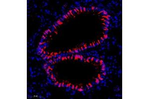 Immunofluorescence of paraffin embedded mouse lung using CYP2S1 (ABIN7073673) at dilution of 1:600 (300x lens) (CYP2S1 antibody)