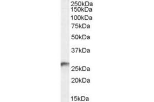 ABIN238652 (0. (BDH2 antibody  (Internal Region))
