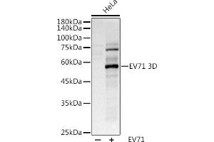 Western blot analysis of extracts of various cell lines, using (ABIN6127666, ABIN6140342, ABIN6140343 and ABIN6224720) at 1:1000 dilution.
