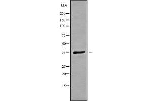Western blot analysis GNB3 using A549 whole cell lysates (GNB3 antibody  (C-Term))