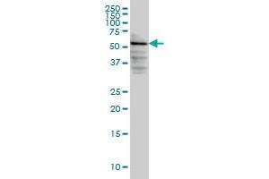 DGKE monoclonal antibody (M03), clone 7E1 Western Blot analysis of DGKE expression in HeLa . (DGKE antibody  (AA 141-240))