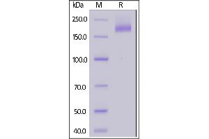 SDS-PAGE (SDS) image for SARS-Coronavirus Spike Protein (SARS-CoV S) (AA 14-1195) (Active) protein (His tag) (ABIN7013276)