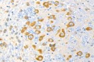 Immunohistochemistry analysis of paraffin-embedded mouse cerebellum using p39 (ABIN7074968) at dilution of 1: 1500 (p39 antibody)
