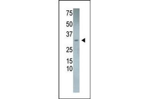 The anti-DSCR1L2 Pab (ABIN390293 and ABIN2840732) is used in Western blot to detect DSCR1L2 in mouse heart tissue lysate. (RCAN3 antibody  (N-Term))