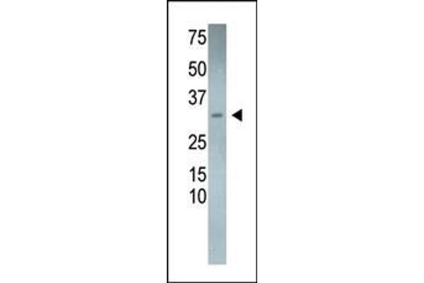 RCAN3 antibody  (N-Term)