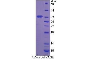 SDS-PAGE analysis of Mouse PCDH15 Protein. (PCDH15 Protein)