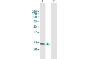 Western Blot analysis of GALNT9 expression in transfected 293T cell line by GALNT9 MaxPab polyclonal antibody. (GALNT9 antibody  (AA 1-237))