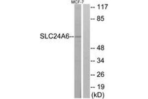 Western blot analysis of extracts from MCF-7 cells, using SLC24A6 Antibody. (SLC24A6 antibody  (AA 494-543))