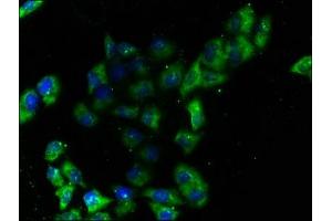 Immunofluorescence staining of Hela cells with ABIN7151622 at 1:100, counter-stained with DAPI. (Endoglin antibody  (AA 32-259))