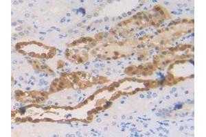 Detection of S100A2 in Human Kidney Tissue using Polyclonal Antibody to S100 Calcium Binding Protein A2 (S100A2) (S100A2 antibody  (AA 2-98))