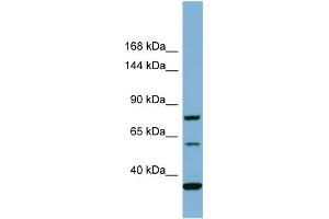 Host:  Rabbit  Target Name:  MYO16  Sample Type:  COLO205 Whole cell lysates  Antibody Dilution:  1. (Myosin XVI antibody  (Middle Region))