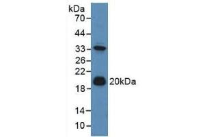 Detection of ADM in Mouse Liver Tissue using Polyclonal Antibody to Adrenomedullin (ADM) (Adrenomedullin antibody  (AA 24-171))