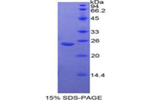 SDS-PAGE (SDS) image for Insulin-Like Growth Factor Binding Protein 7 (IGFBP7) (AA 88-281) protein (His tag) (ABIN2125307) (IGFBP7 Protein (AA 88-281) (His tag))