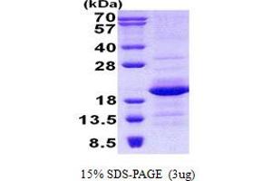 GEMIN6 Protein (His tag)