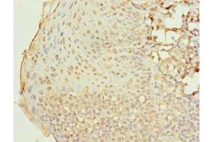 Immunohistochemistry of paraffin-embedded human tonsil tissue using ABIN7167298 at dilution of 1:100 (RAB33A antibody  (AA 1-237))