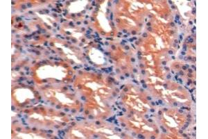 Detection of ICAM1 in Porcine Kidney Tissue using Polyclonal Antibody to Intercellular Adhesion Molecule 1 (ICAM1) (ICAM1 antibody  (AA 27-209))