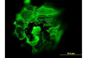 Immunofluorescence of monoclonal antibody to TP53 on A-431 cell. (p53 antibody  (AA 94-201))