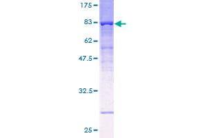 ATP6V1B1 Protein (AA 1-513) (GST tag)