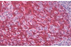 Image no. 1 for anti-Stratifin (SFN) (AA 120-170) antibody (ABIN1490876) (14-3-3 sigma/SFN antibody  (AA 120-170))