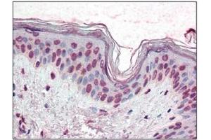 Immunohistochemistry (IHC) image for anti-X-Box Binding Protein 1 (XBP1) (AA 2-160) antibody (ABIN492538) (XBP1 antibody  (AA 2-160))
